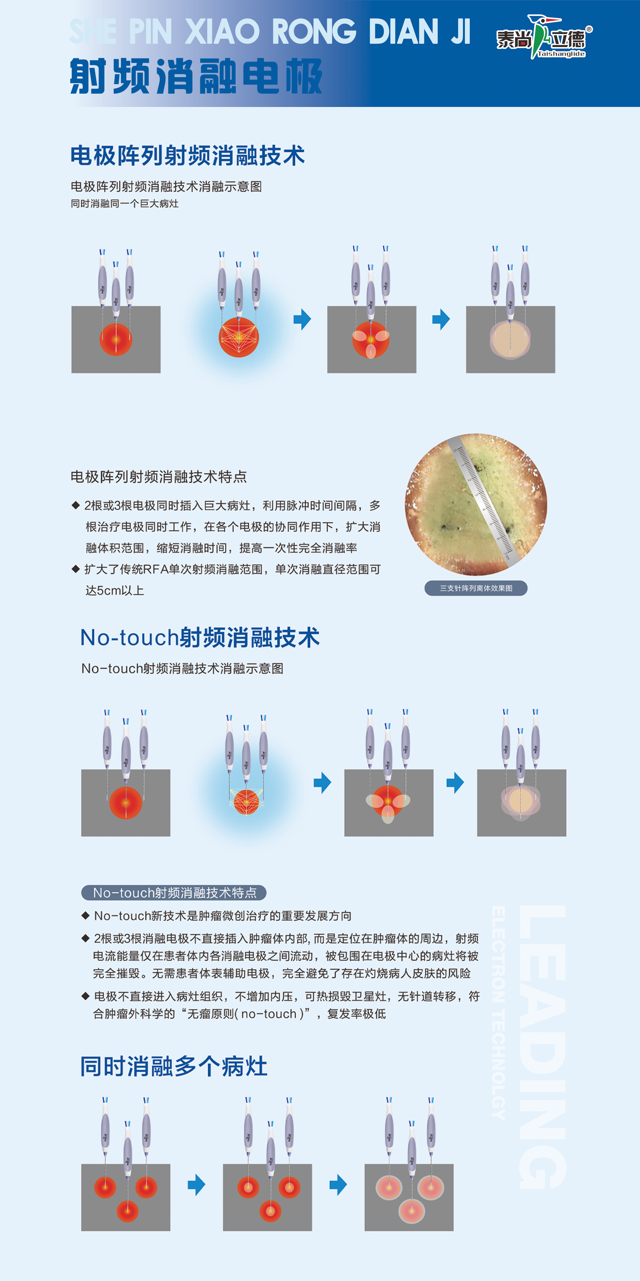 射頻消融電極 技術特點