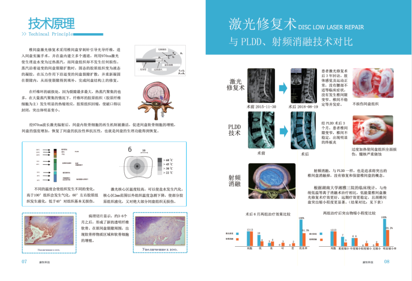 激光修復術